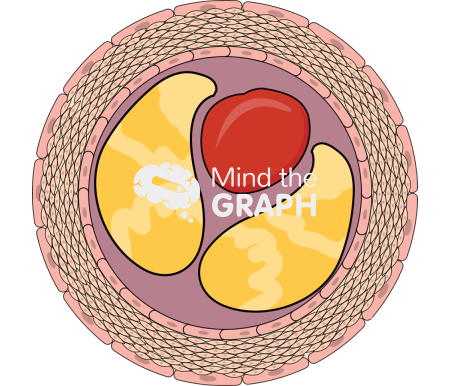 Atheroma 6 Icons, Symbols, Pictures, and Images