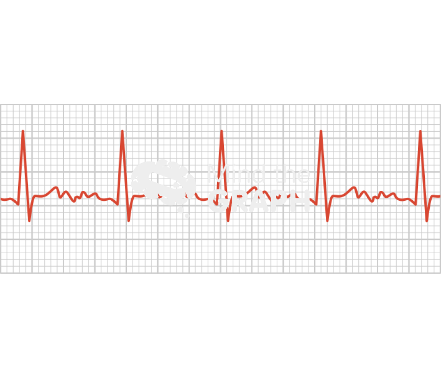 Atrial fibrilation electrocardiogram Icons, Symbols, Pictures, and Images