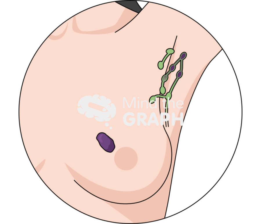 Axillary breast lymph node zoom Icons, Symbols, Pictures, and Images