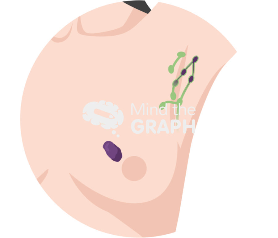 Axillary breast lymph node zoom Icons, Symbols, Pictures, and Images