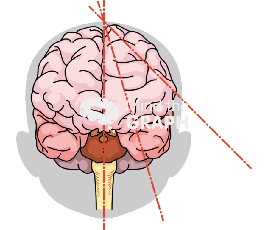 Baby brain cutting plans shape front Icons, Symbols, Pictures, and Images
