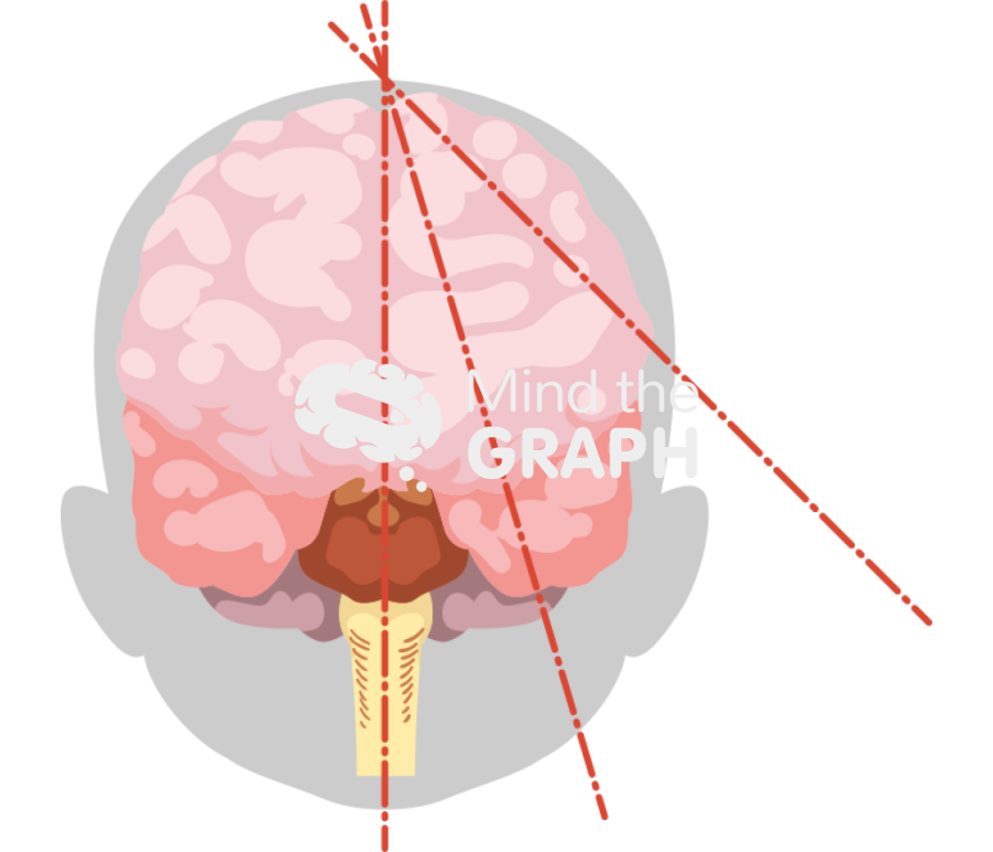 Baby brain cutting plans shape front Icons, Symbols, Pictures, and Images