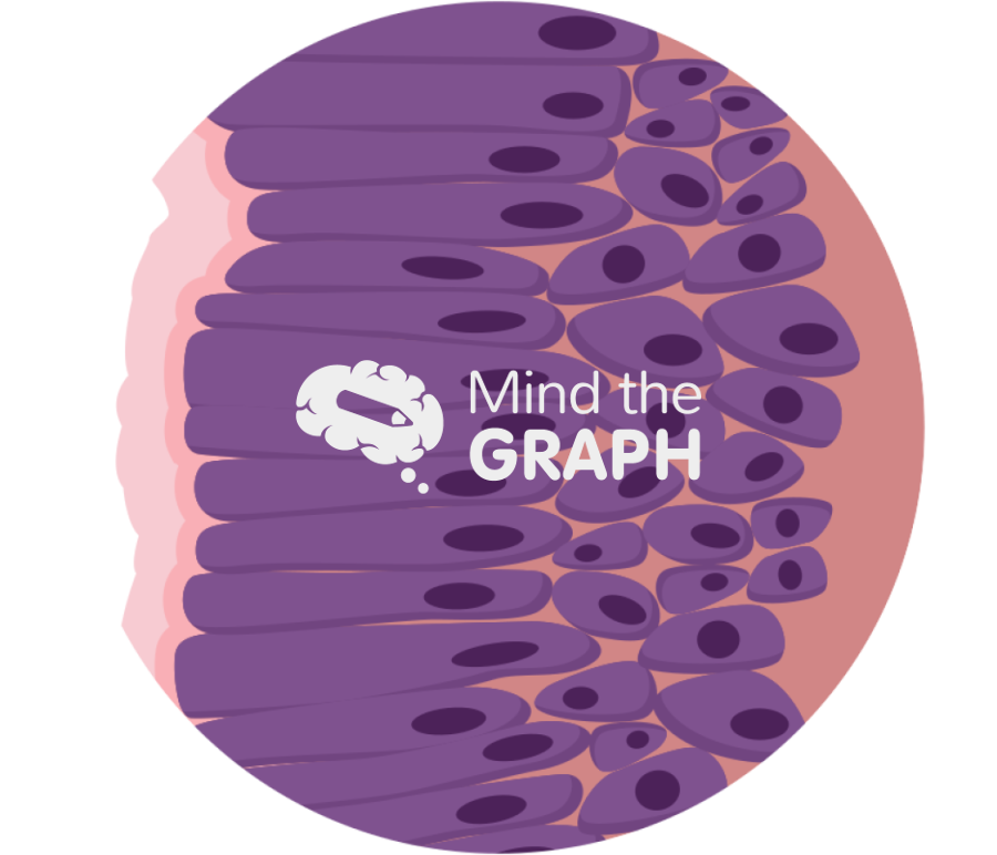 Barrett esophagus 2 zoom Icons, Symbols, Pictures, and Images