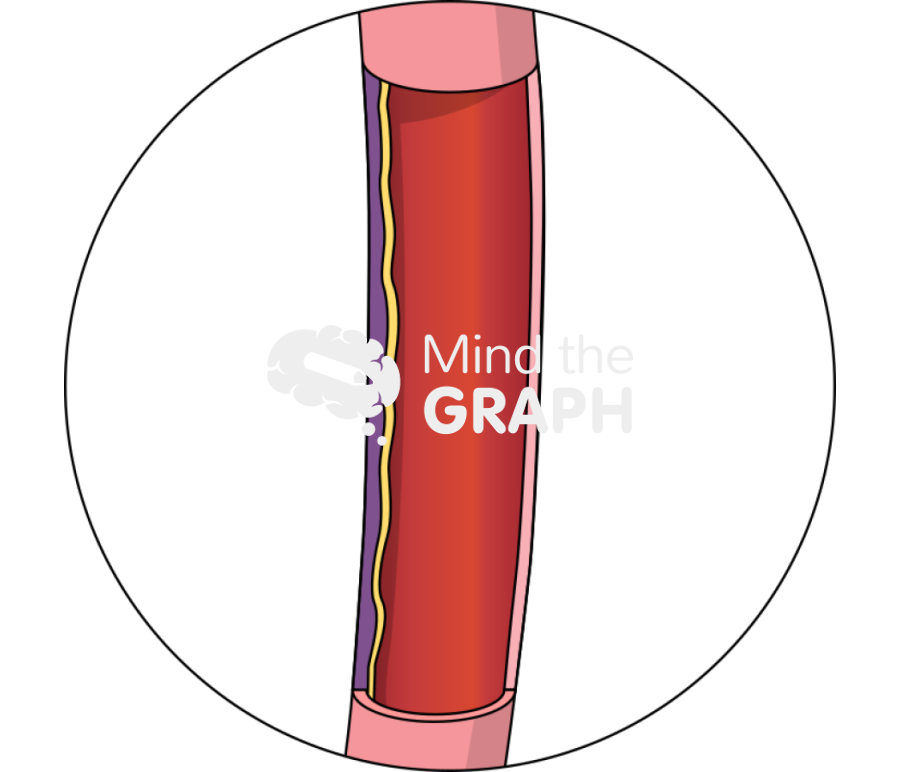 Barrett esophagus zoom Icons, Symbols, Pictures, and Images