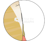 Before teeth whitening hidroxyapatyte zoom - Edit and Customize Icons of Before teeth whitening hidroxyapatyte zoom Before teeth whitening hidroxyapatyte zoom Icons, Symbols, Pictures, and Images