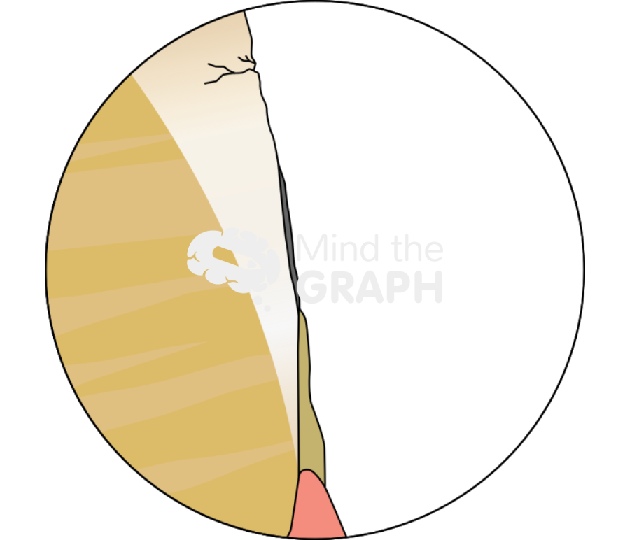 Before teeth whitening hidroxyapatyte zoom Icons, Symbols, Pictures, and Images