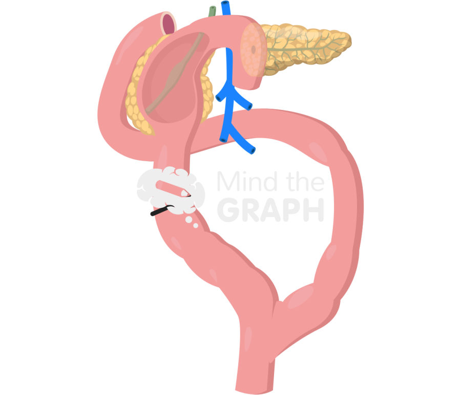 Beger procedure Icons, Symbols, Pictures, and Images