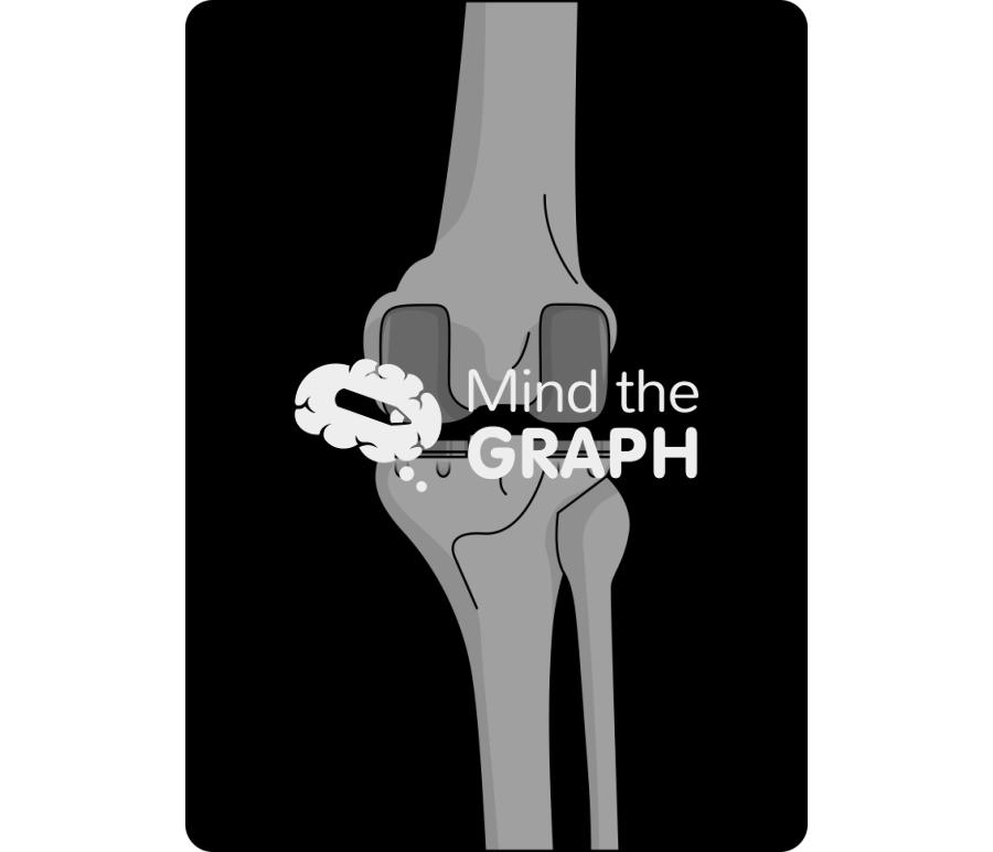 Bicondylar knee arthroplasty anterior posterior x ray Icons, Symbols, Pictures, and Images