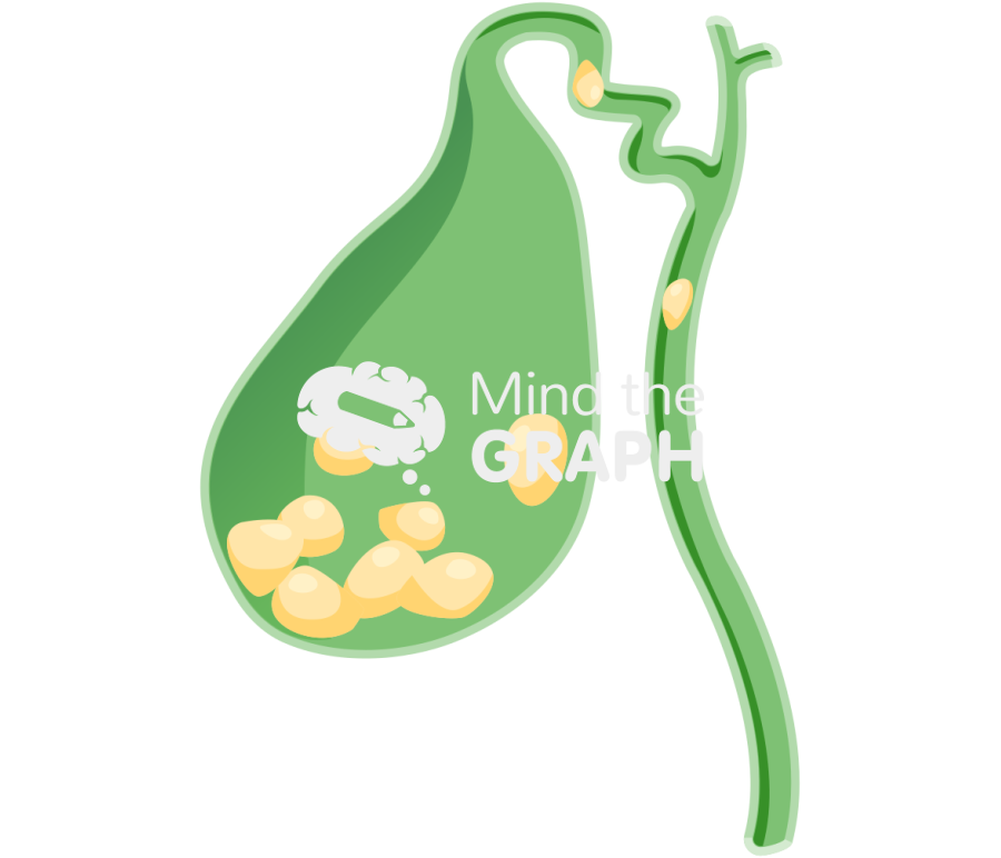 Big calculi biliary lithiasis Icons, Symbols, Pictures, and Images