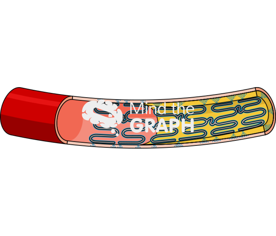 Bioresorbable polymer coated stent Icons, Symbols, Pictures, and Images