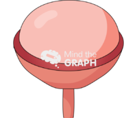 Bladder hemicystectomy 4 - Edit and Customize Icons of Bladder hemicystectomy 4 Bladder hemicystectomy 4 Icons, Symbols, Pictures, and Images