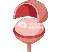 Bladder hemicystectomy 5 - Edit and Customize Icons of Bladder hemicystectomy 5 Bladder hemicystectomy 5 Icons, Symbols, Pictures, and Images