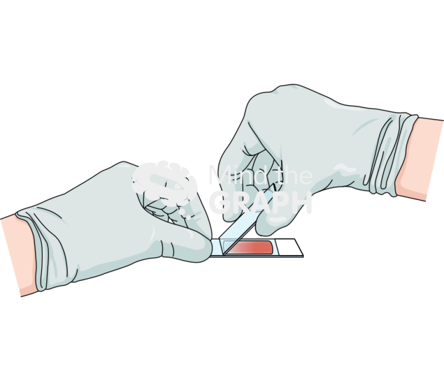 Blood smear film procedure 3 Icons, Symbols, Pictures, and Images