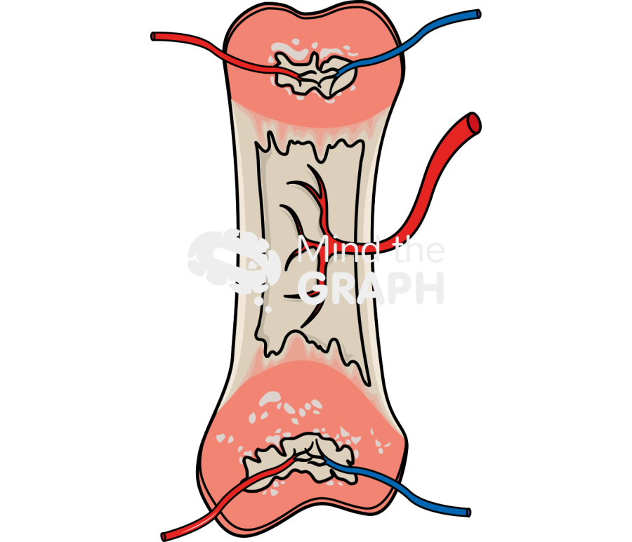Bone growth 3 Icons, Symbols, Pictures, and Images