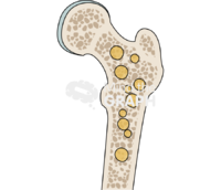 Bone marrow adipose tissue - Edit and Customize Icons of Bone marrow adipose tissue Bone marrow adipose tissue Icons, Symbols, Pictures, and Images