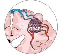 Brain arteriovenous malformation zoom Icons, Symbols, Pictures, and Images