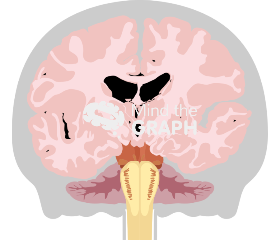 Brain cranium frontal cut shape Icons, Symbols, Pictures, and Images
