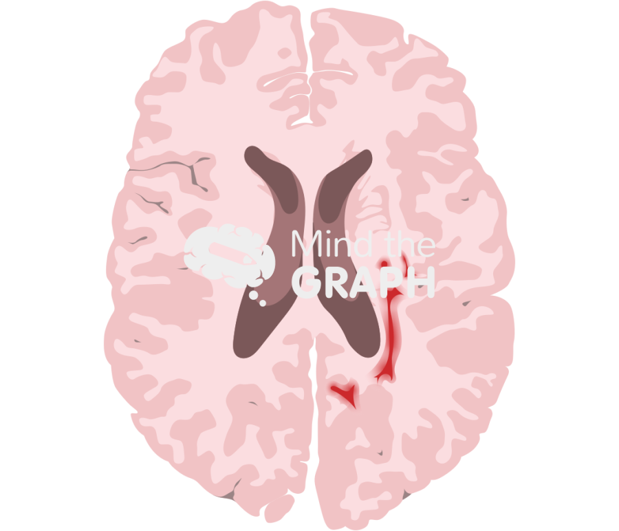 Brain cut affected Icons, Symbols, Pictures, and Images