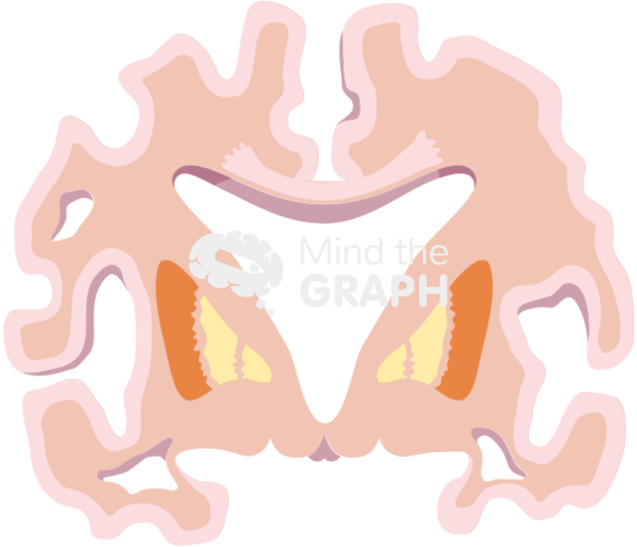 Brain cut alzheimer severe disease Icons, Symbols, Pictures, and Images