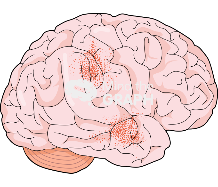 Brain meningitis Icons, Symbols, Pictures, and Images