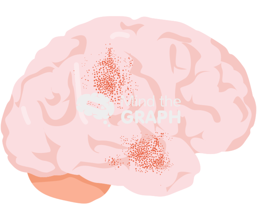 Brain meningitis Icons, Symbols, Pictures, and Images