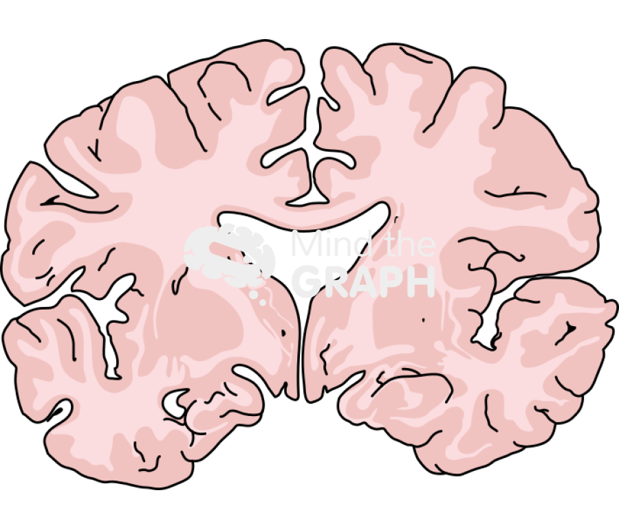 Brain mild alzheimer disease front cut Icons, Symbols, Pictures, and Images
