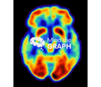 Brain scan mri top Icons, Symbols, Pictures, and Images