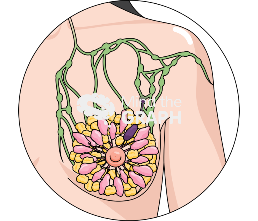 Breast cancer lymph node zoom Icons, Symbols, Pictures, and Images