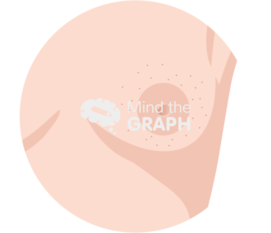 Breast peau dorange sign Icons, Symbols, Pictures, and Images