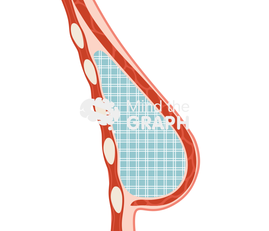 Breast tissue fat regeneration cut 1 Icons, Symbols, Pictures, and Images