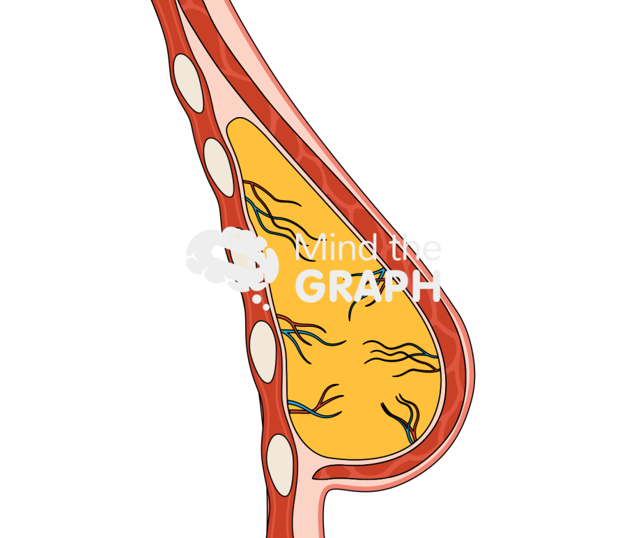 Breast tissue fat regeneration cut 3 Icons, Symbols, Pictures, and Images