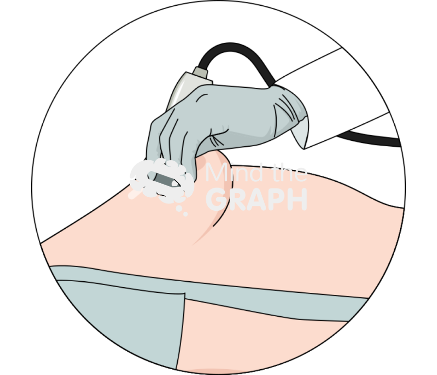 Breast ultrasound zoom Icons, Symbols, Pictures, and Images