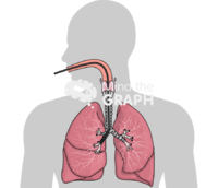 Bronchoscopy - Edit and Customize Icons of Bronchoscopy Bronchoscopy Icons, Symbols, Pictures, and Images