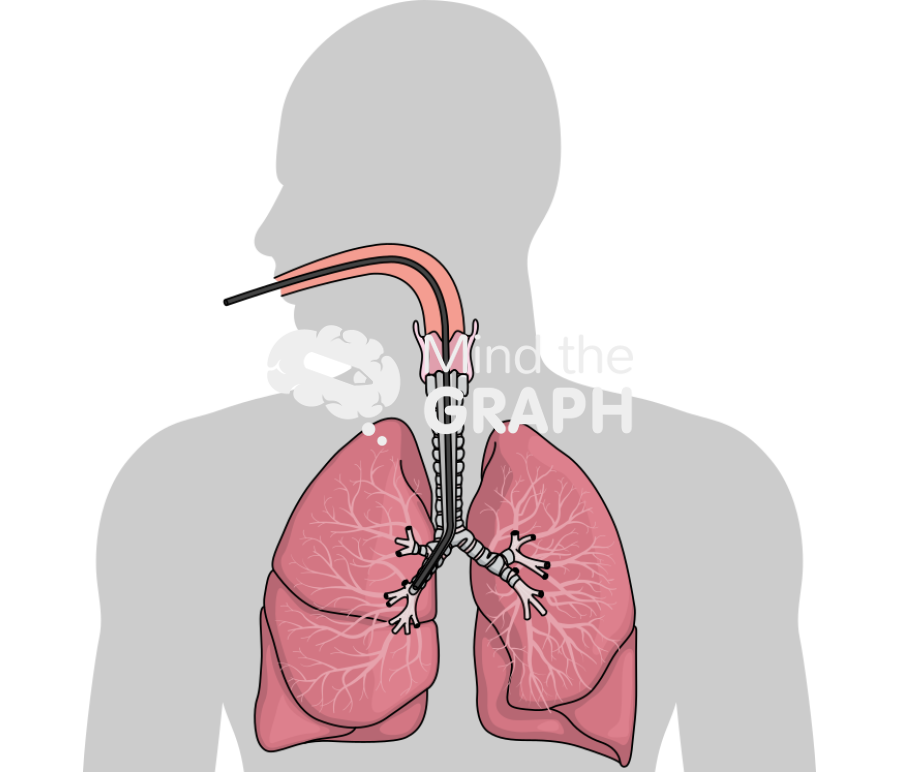 Bronchoscopy Icons, Symbols, Pictures, and Images