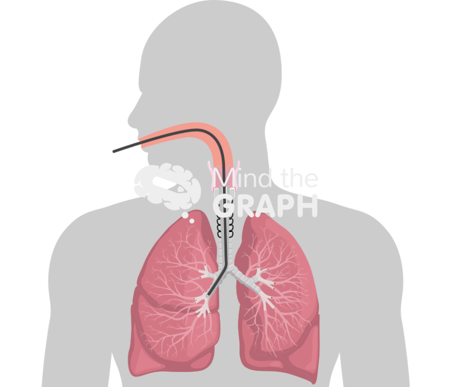 Bronchoscopy Icons, Symbols, Pictures, and Images