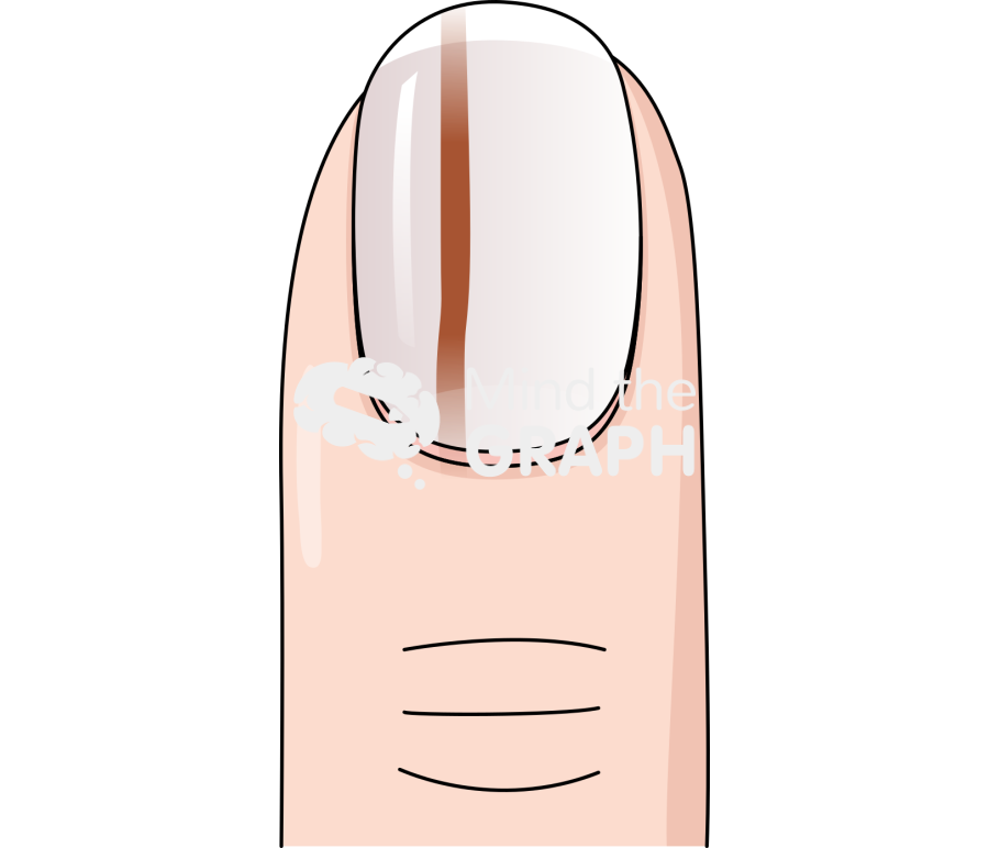 Brown line pigmentation nail front Icons, Symbols, Pictures, and Images