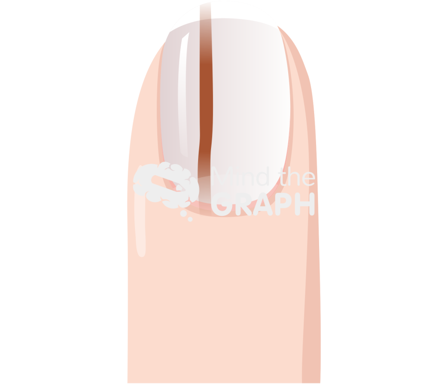 Brown line pigmentation nail front Icons, Symbols, Pictures, and Images