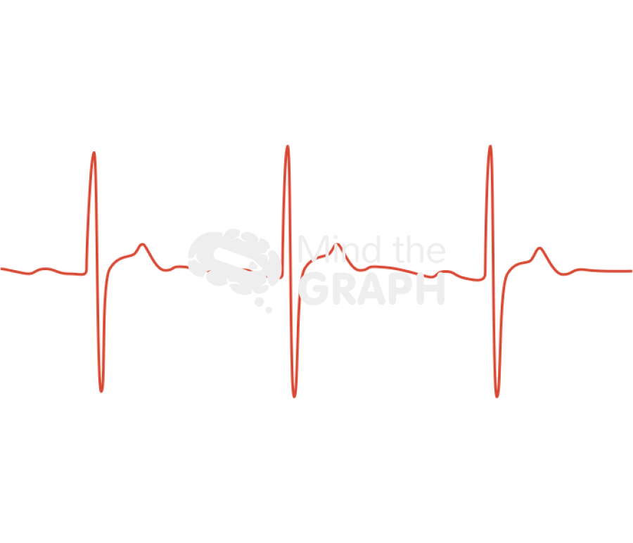 Brugada syndrome v3 electrocardiogram Icons, Symbols, Pictures, and Images