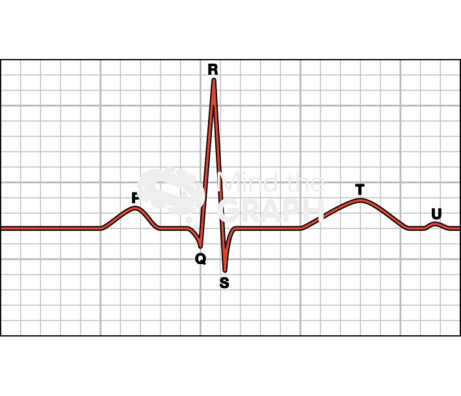 Cardiac cycle electrocardiograma 1 Icons, Symbols, Pictures, and Images