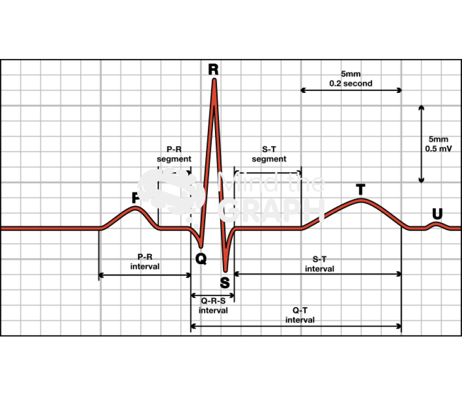 Cardiac cycle electrocardiograma 2 Icons, Symbols, Pictures, and Images