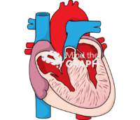 Cardiac hypertrophy 2 - Edit and Customize Icons of Cardiac hypertrophy 2 Cardiac hypertrophy 2 Icons, Symbols, Pictures, and Images