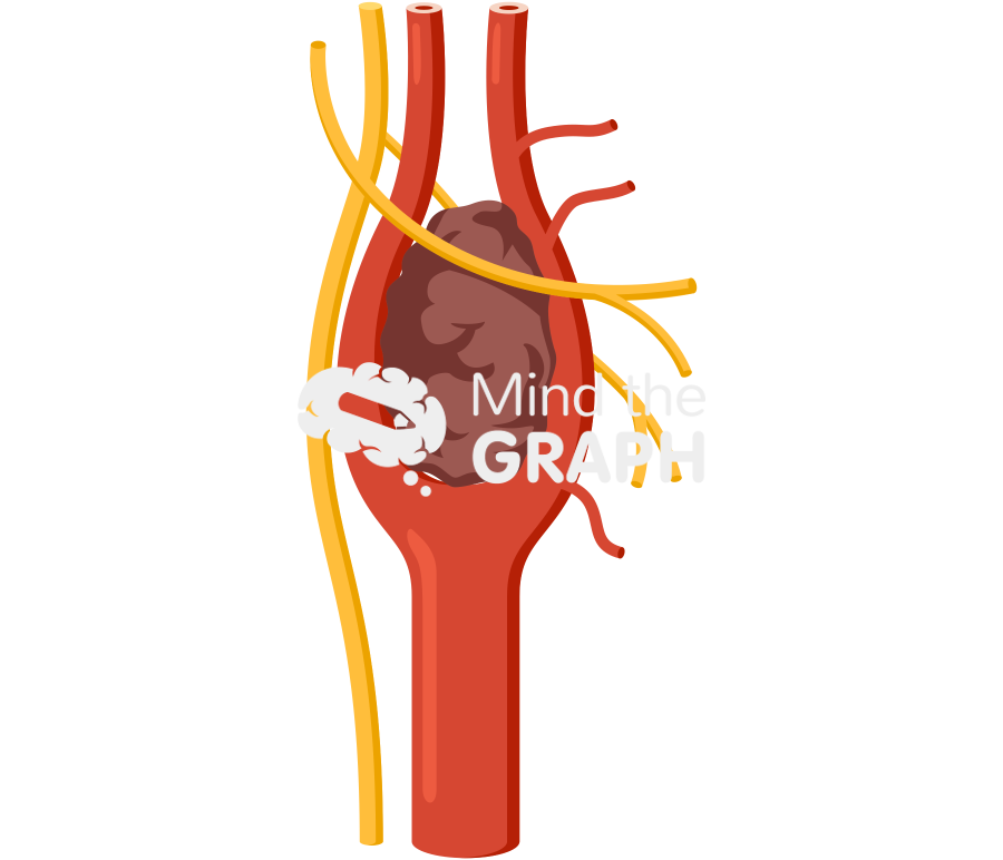 Carotid body tumor type 1 Icons, Symbols, Pictures, and Images