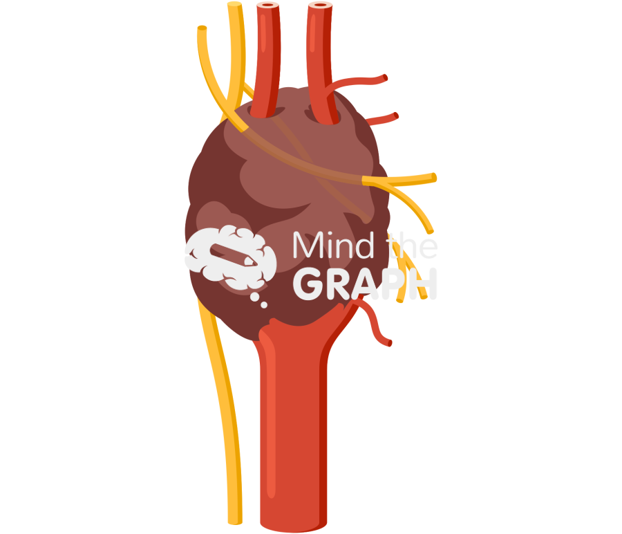 Carotid body tumor type 3 Icons, Symbols, Pictures, and Images