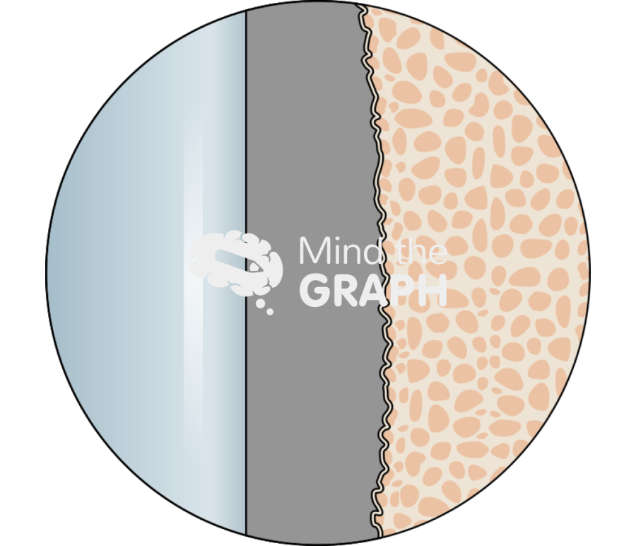 Cemented stem implant cement bone interface zoom Icons, Symbols, Pictures, and Images