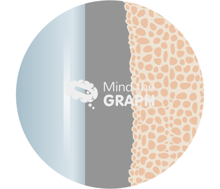 Cemented stem implant cement bone interface zoom Icons, Symbols, Pictures, and Images