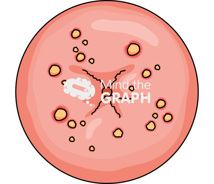 Cervix infection 2 Icons, Symbols, Pictures, and Images