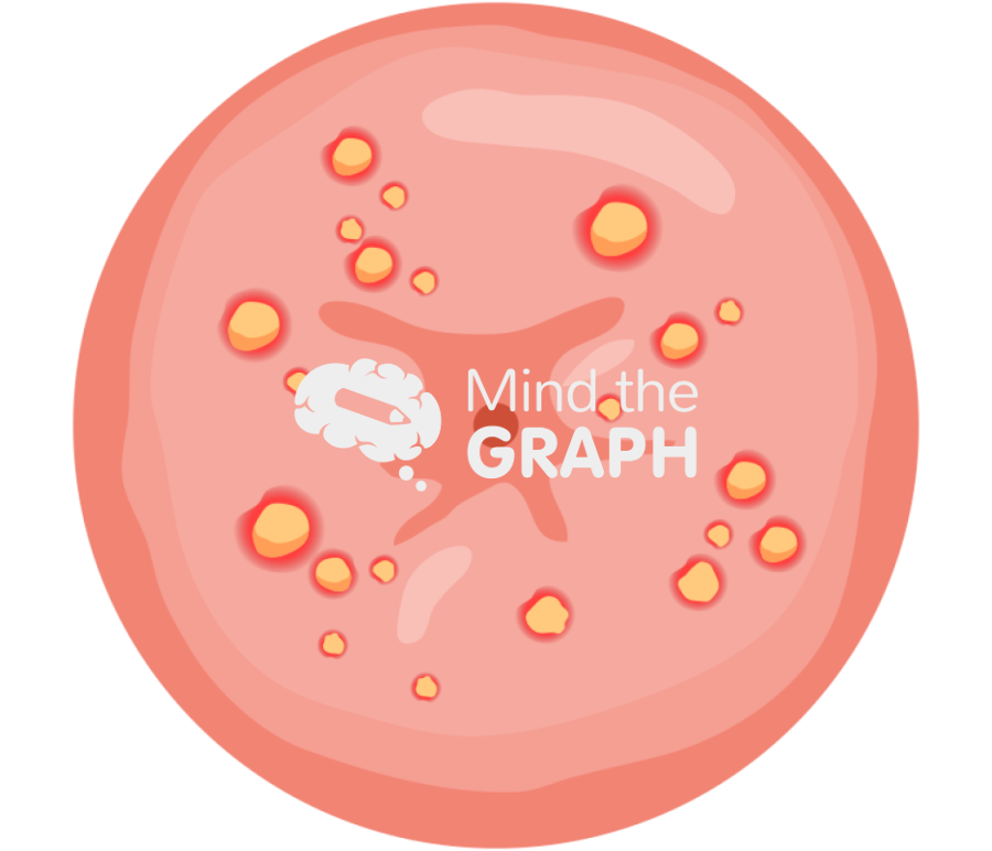 Cervix infection 2 Icons, Symbols, Pictures, and Images