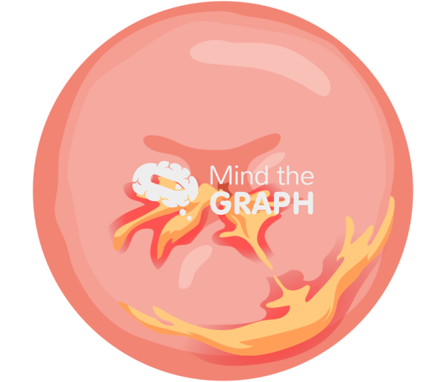 Cervix infection 3 Icons, Symbols, Pictures, and Images