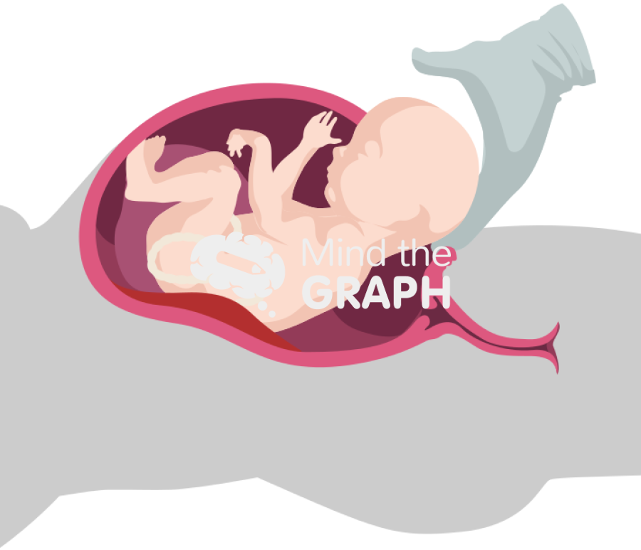 Cesarean section procedure lateral shape Icons, Symbols, Pictures, and Images