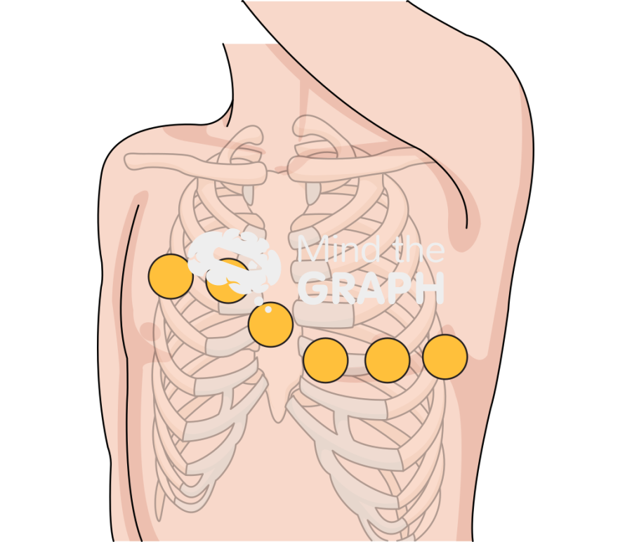 Chest thorax leads ecg lateral Icons, Symbols, Pictures, and Images